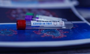 COVID-19 – nowe laboratorium diagnostyczne. Wspólna inicjatywa MIBMiK, IBB PAN, IMDiK PAN i