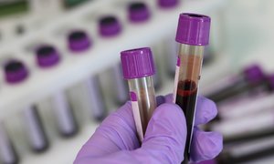 Czwarta edycja grantu naukowego Fundacji DKMS