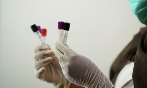 Analityka składników śladowych w praktyce laboratoryjnej
