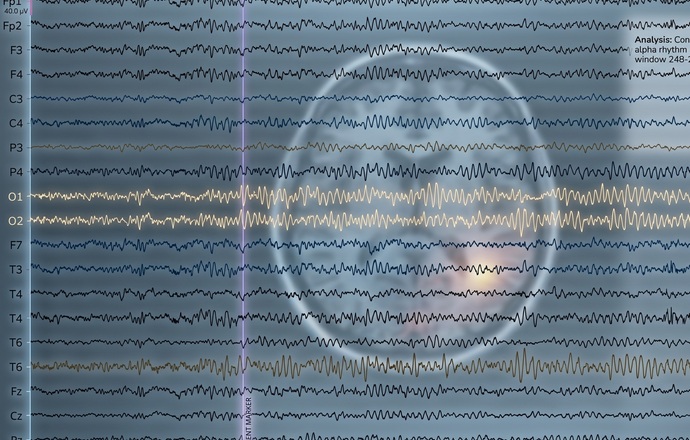 Rodzaj przyjmowanego leku można wyczytać z zapisu EEG 