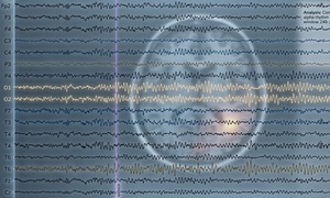 Rodzaj przyjmowanego leku można wyczytać z zapisu EEG 