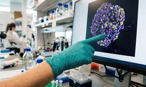 Czy można zatrzymać śmierć komórki? Polscy naukowcy odpowiadają na łamach „Nature”